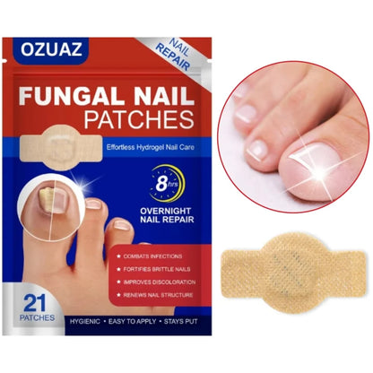 OZUAZ Hydrogel Anti Fungal Nail Correction Stickers